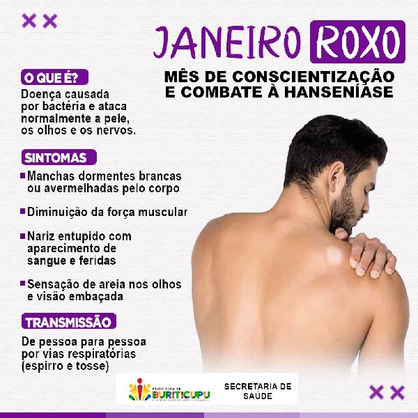 JANEIRO ROXO - MÊS DA CONSCIENTIZAÇÃO E COMBATE À HANSENÍASE.